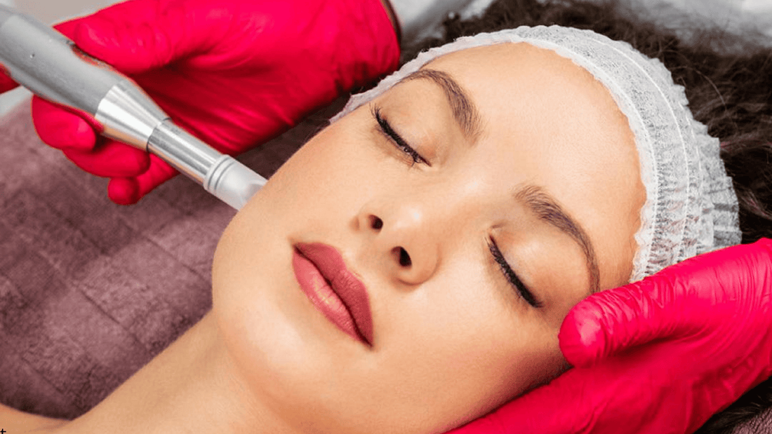 Microneedling-behandling i ansiktet utförd av hudterapeut, exempel på professionell behandling och hur ofta man bör göra microneedling för bästa resultat och säker hudförnyelse