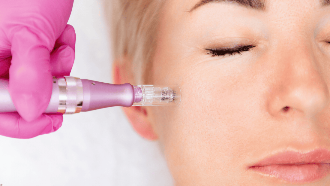 Microneedling under ögonen med dermapen utförd av hudterapeut, närbild som visar behandling av känsligt ögonområde och illustrerar om microneedling under ögonen är säkert och effektivt